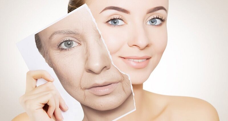 Approaches to Anti-Aging