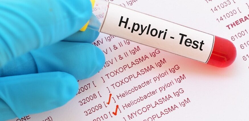 Management Of H. Pylori